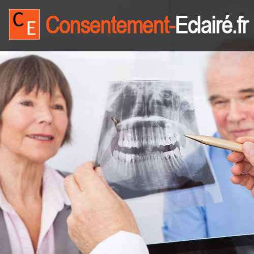 Consentement Eclaire